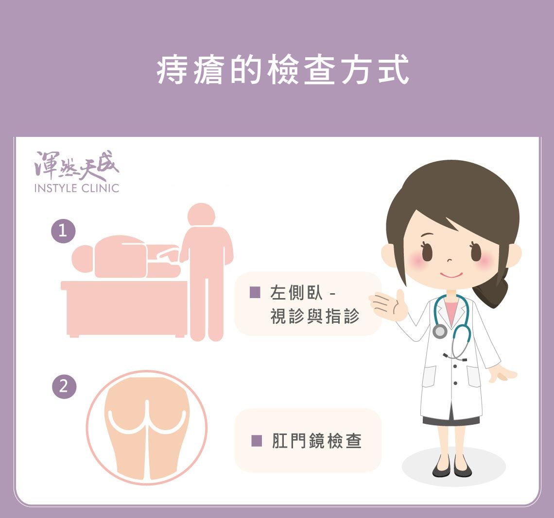 痔瘡的檢查方式 痔瘡的檢查方式有視診、指診、肛門鏡檢查