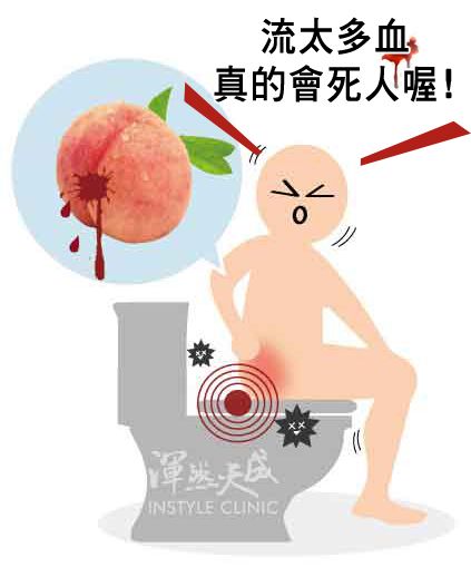 10秒測試我得痔瘡了嗎 10秒測試我是不是得痔瘡了