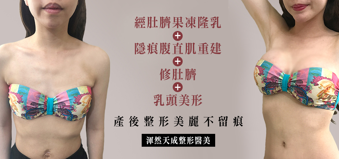 渾然天成整形醫美 渾然天成整形醫美