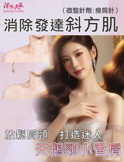 斜方肌瘦肩針微整。|渾然天成整形醫美 斜方肌瘦肩針微整。|渾然天成整形醫美。