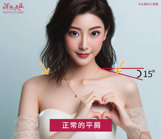 正常的平肩:小於15度較為正常的平肩。|渾然天成整形醫美 正常的平肩:小於15度較為正常的平肩。|渾然天成整形醫美