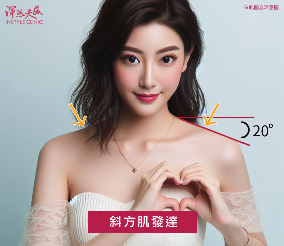 斜方肌發達:大於20度的斜肩(斜方肌發達)。|渾然天成整形醫美 斜方肌發達:大於20度的斜肩(斜方肌發達)。|渾然天成整形醫美