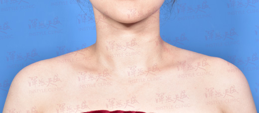 Modified Image