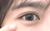 眼袋