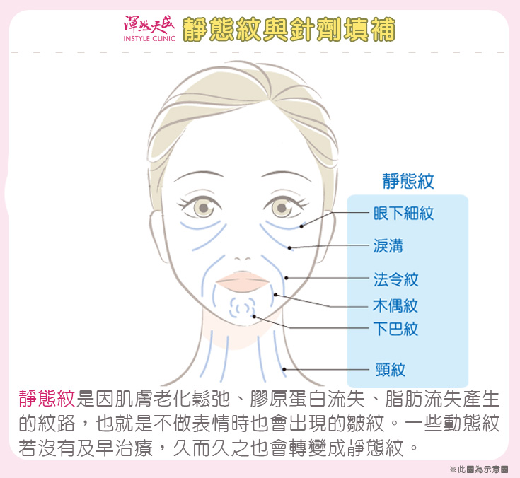 渾然天成整形醫美|靜態紋 渾然天成整形醫美|靜態紋