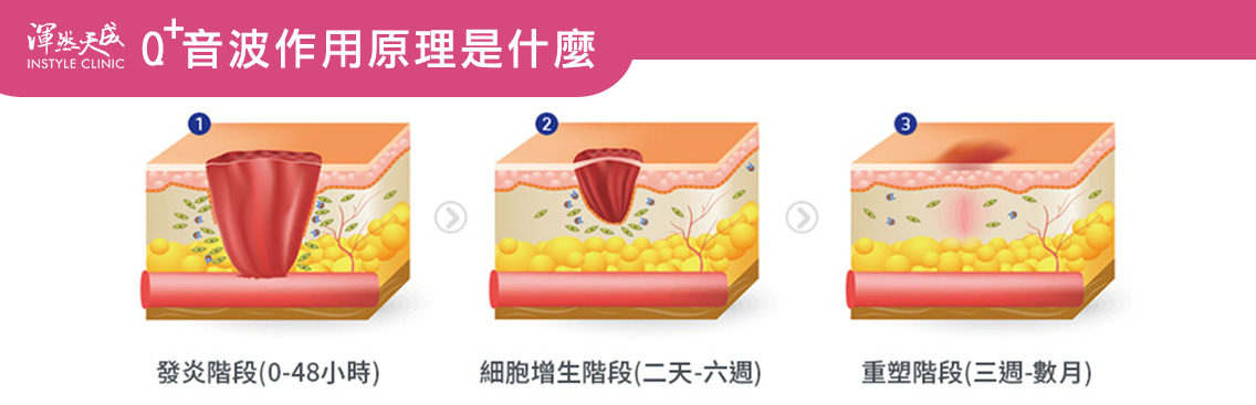 渾然天成整形醫美|作用原理。 渾然天成整形醫美|作用原理。