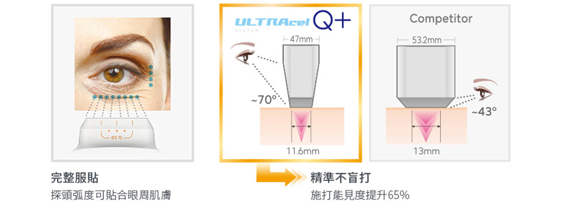 渾然天成整形醫美|探頭弧度可貼合眼周肌膚。精準不盲打。