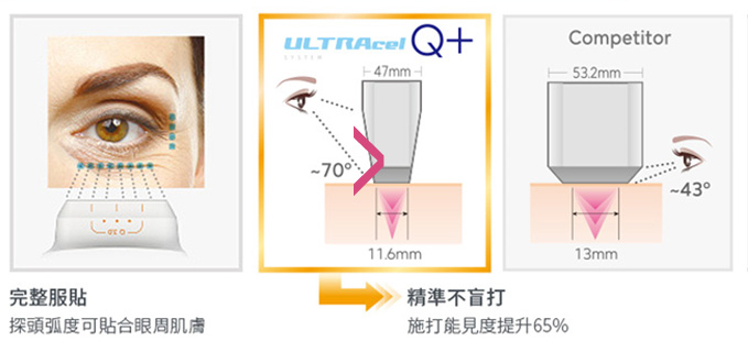 渾然天成整形醫美|探頭弧度可貼合眼周肌膚。精準不盲打。