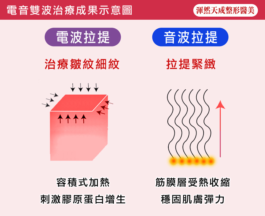 電音雙波治療成果示意圖 電音雙波治療成果示意圖