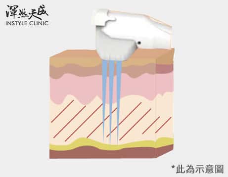 效果立即有感 效果立即有感