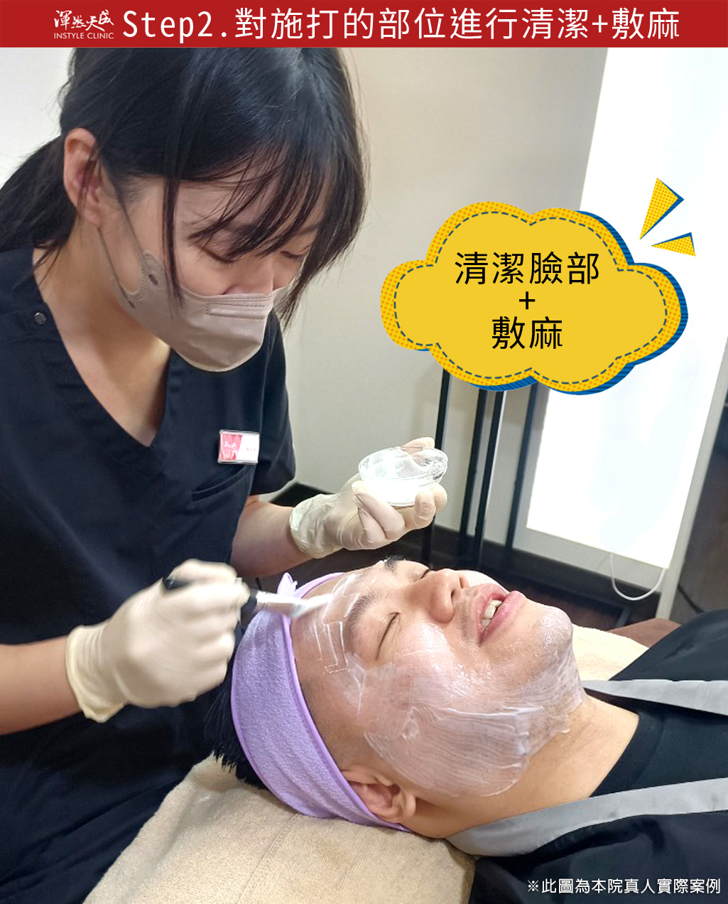 渾然天成整形醫美|墨菲斯微針電波-對施打的部位進行清潔+敷麻 渾然天成整形醫美|墨菲斯微針電波-對施打的部位進行清潔+敷麻