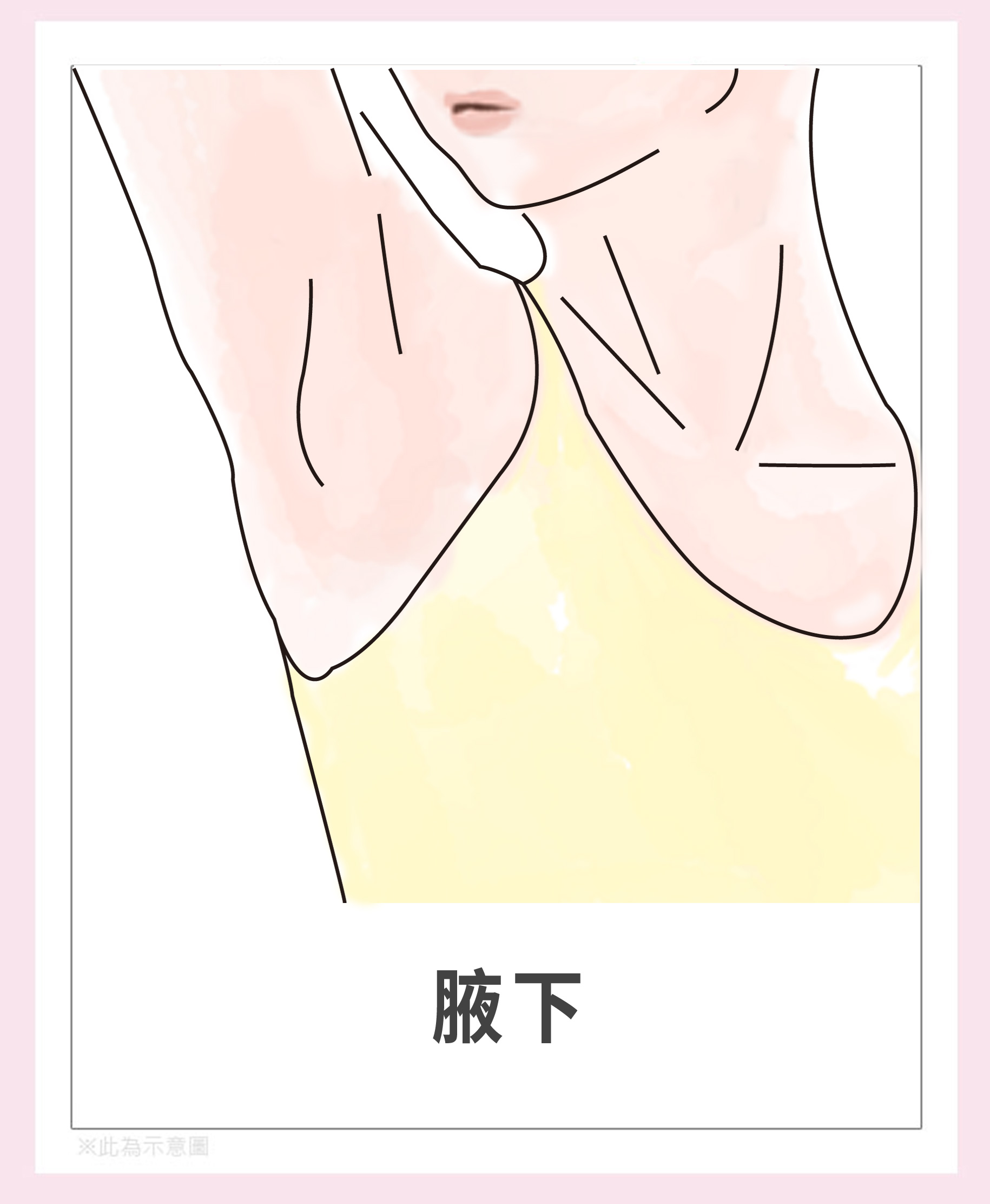 女性私密處除毛-腋下除毛。|渾然天成整形醫美 女性私密處除毛-腋下除毛。|渾然天成整形醫美