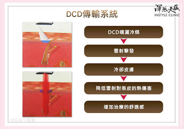 女性私密處-透過DCD傳輸冷卻系統、降低雷射熱傷害,增加療程舒適度。|渾然天成整形醫美 女性私密處-透過DCD傳輸冷卻系統、降低雷射熱傷害,增加療程舒適度。|渾然天成整形醫美。