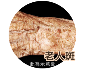 渾然天成,雷射除斑