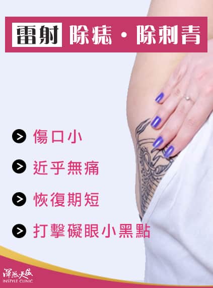 渾然天成,除痣,除刺青 渾然天成,除痣,除刺青