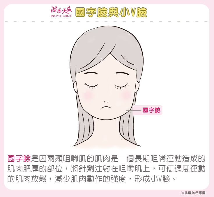渾然天成整形醫美|針劑微整-國字臉、小V臉 渾然天成整形醫美|針劑微整-國字臉、小V臉