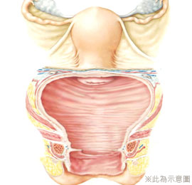 陰道鬆弛,困擾,私密處不舒服,妹妹養,妹妹不舒服,私密處保養方法,月經,女性疾病,私密處衛教,私密處要注意,陳淑賢醫師,渾然天成,嚴重鬆弛,更年期,性生活不滿,陰道收縮,愛愛不順,性愛沒感覺,白帶多,分泌物多,私密處感染,泡湯,安全,漏尿,尿失禁,血塊,私密處權威醫師,私密處女醫師