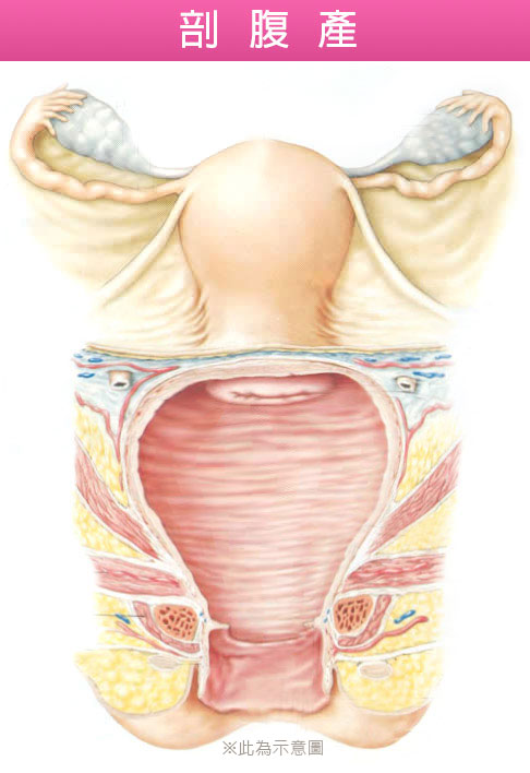 陰道管徑,陰道長度,陰道鬆弛,渾然天成,陳淑賢醫師,剖腹產,自然產,陰道嚴重鬆弛,產後陰道鬆弛