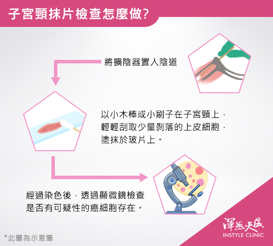 渾然天成整形醫美|子宮頸抹片檢查怎麼做。 渾然天成整形醫美|子宮頸抹片檢查怎麼做。