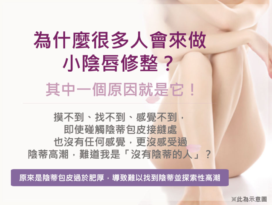 小陰唇,私密處,整形,手術,女性包皮,渾然天成,困擾,小陰脣