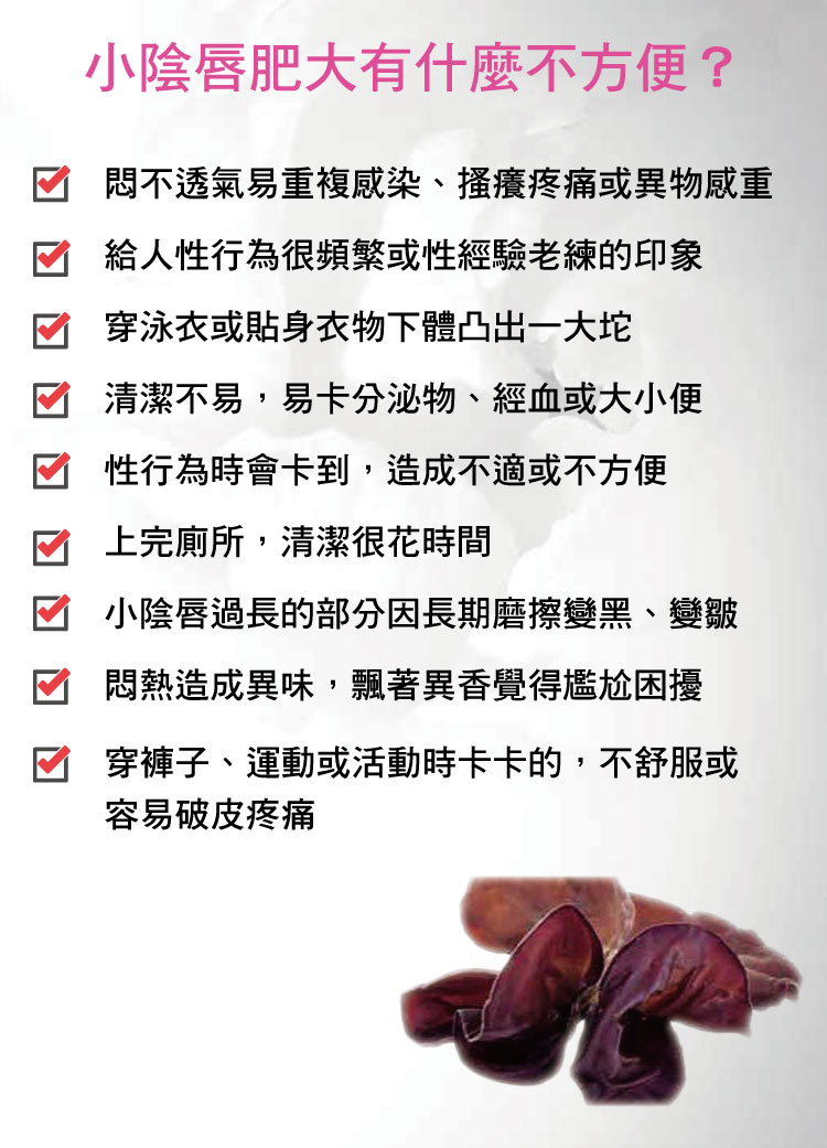 小陰唇,私密處,變黑,過長,女性包皮,渾然天成,困擾,小陰脣