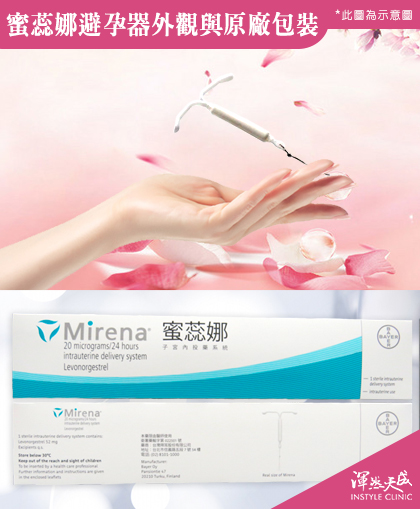 渾然天成整形醫美|蜜蕊娜避孕器外觀與原廠包裝 渾然天成整形醫美|蜜蕊娜避孕器外觀與原廠包裝