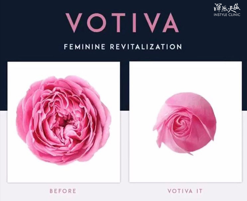 蝴蝶電波VOTIVA 蝴蝶電波VOTIVA