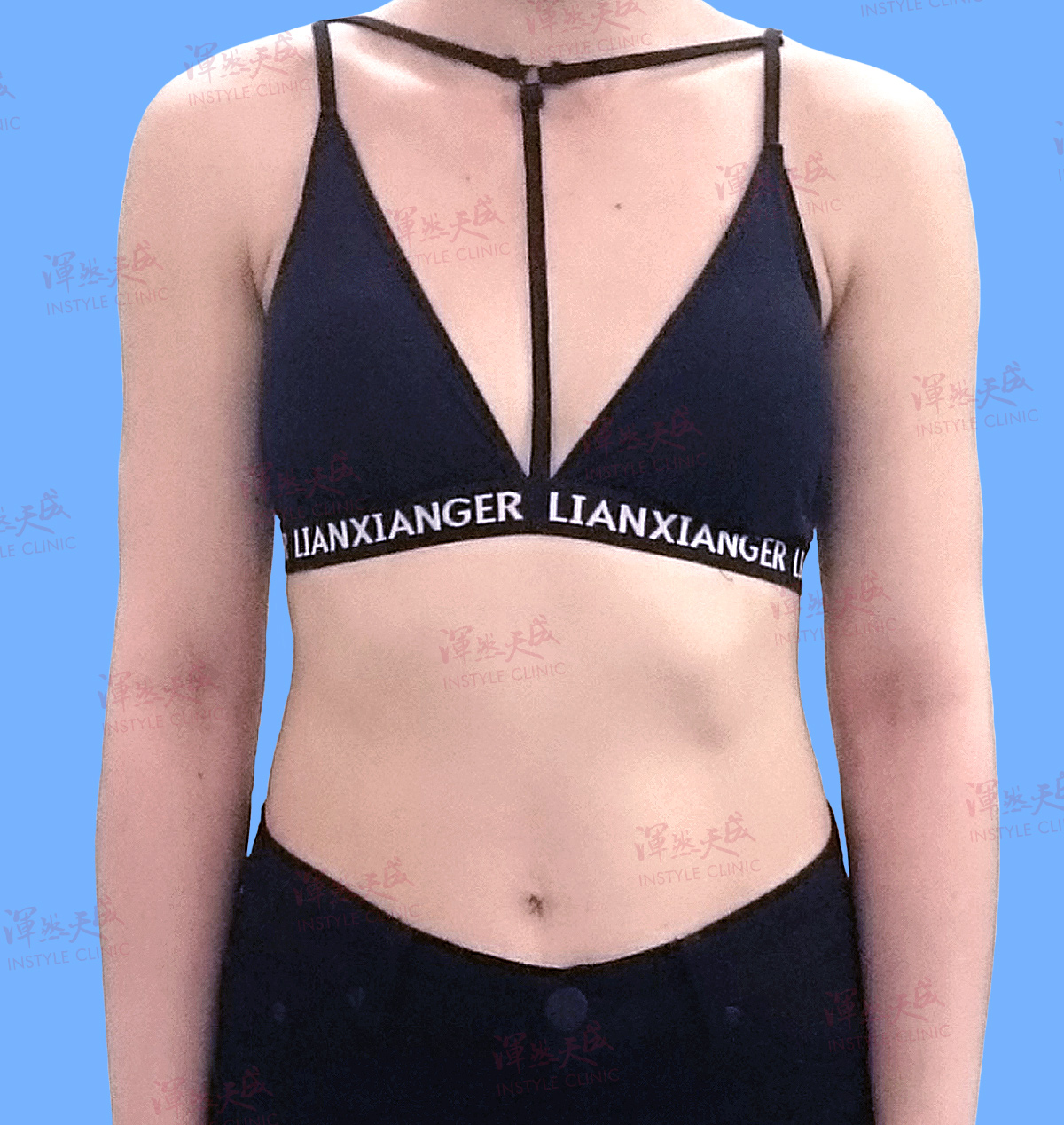 Original Image