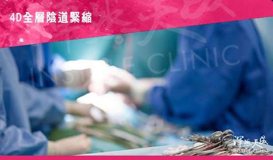 4D全層陰道緊縮手術10項重點 4D全層陰道緊縮與陰道雷射的差別-10項重點