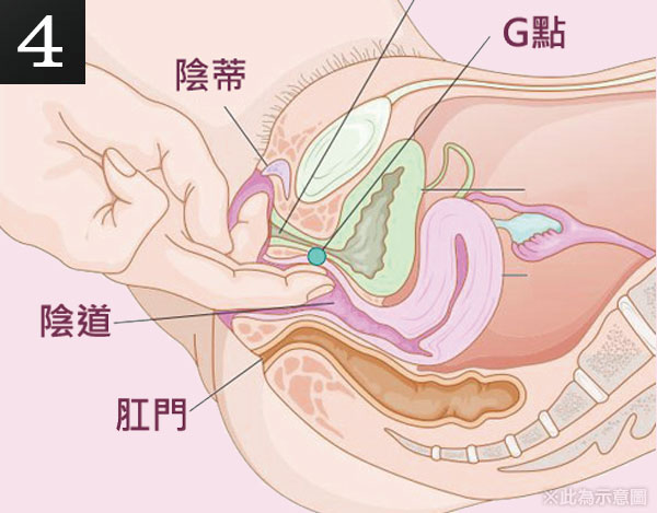 大陰唇,萎縮,皺皺的,乾扁,私密處,自體脂肪填補,手術,飽滿,水嫩,熟女,渾然天成